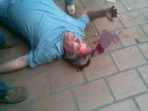 Herido en el Zulia desmiente su muerte y niega ser militante del PSUV (Fotos)