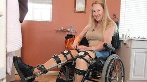 Una mujer sana se va a someter a una operación para convertirse en parapléjica