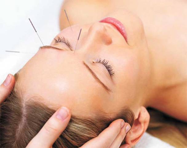 Verdadera o falsa, la acupuntura alivia “sofocos” de la quimioterapia
