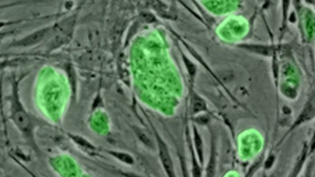 Primera clonación de células adultas para crear células madre embrionarias