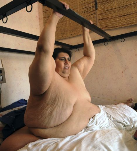 Muere quien fue el hombre más obeso mundo: Manuel Uribe