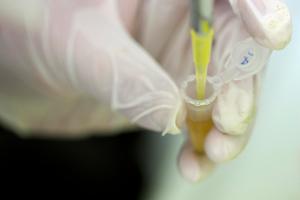 Expertos de Oxford prueban una vacuna contra el ébola