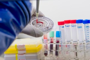 Aceleran las pruebas de una vacuna contra el ébola