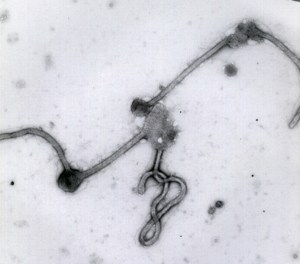 Un caso sospechoso de ébola en Suecia