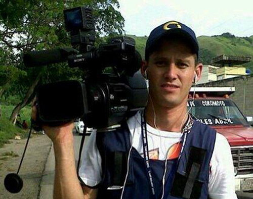 Un edema cerebral presenta camarógrafo agredido en Aragua