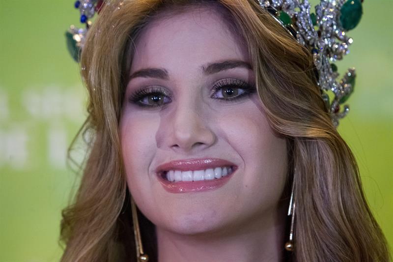 Miss Venezuela 2015 se compromete con lucha contra el labio leporino