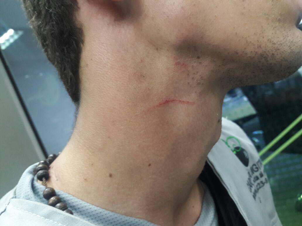 Periodista de Caraota Digital fue robado y agredido por oficialistas #20May (Foto)