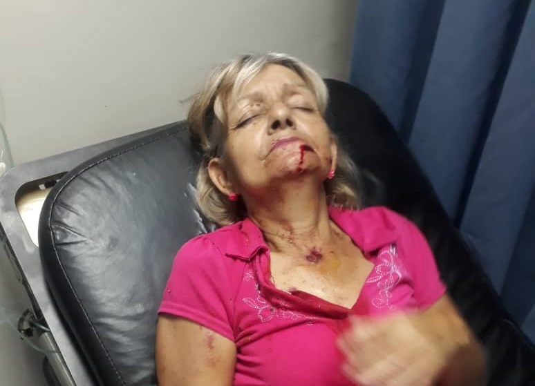 FOTOS EXPLICITAS: Una abuela con un perdignoazo en la cara en Vargas