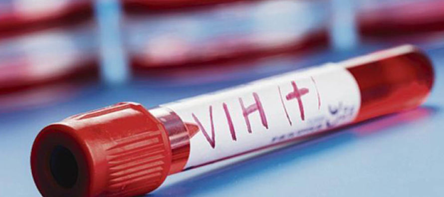 Nueva vacuna podría contener el VIH sin el tratamiento antirretroviral