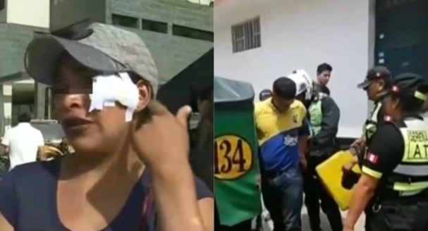 “Dijo que me quería destripar”: Venezolana desfigura a mujer en plena calle en Perú