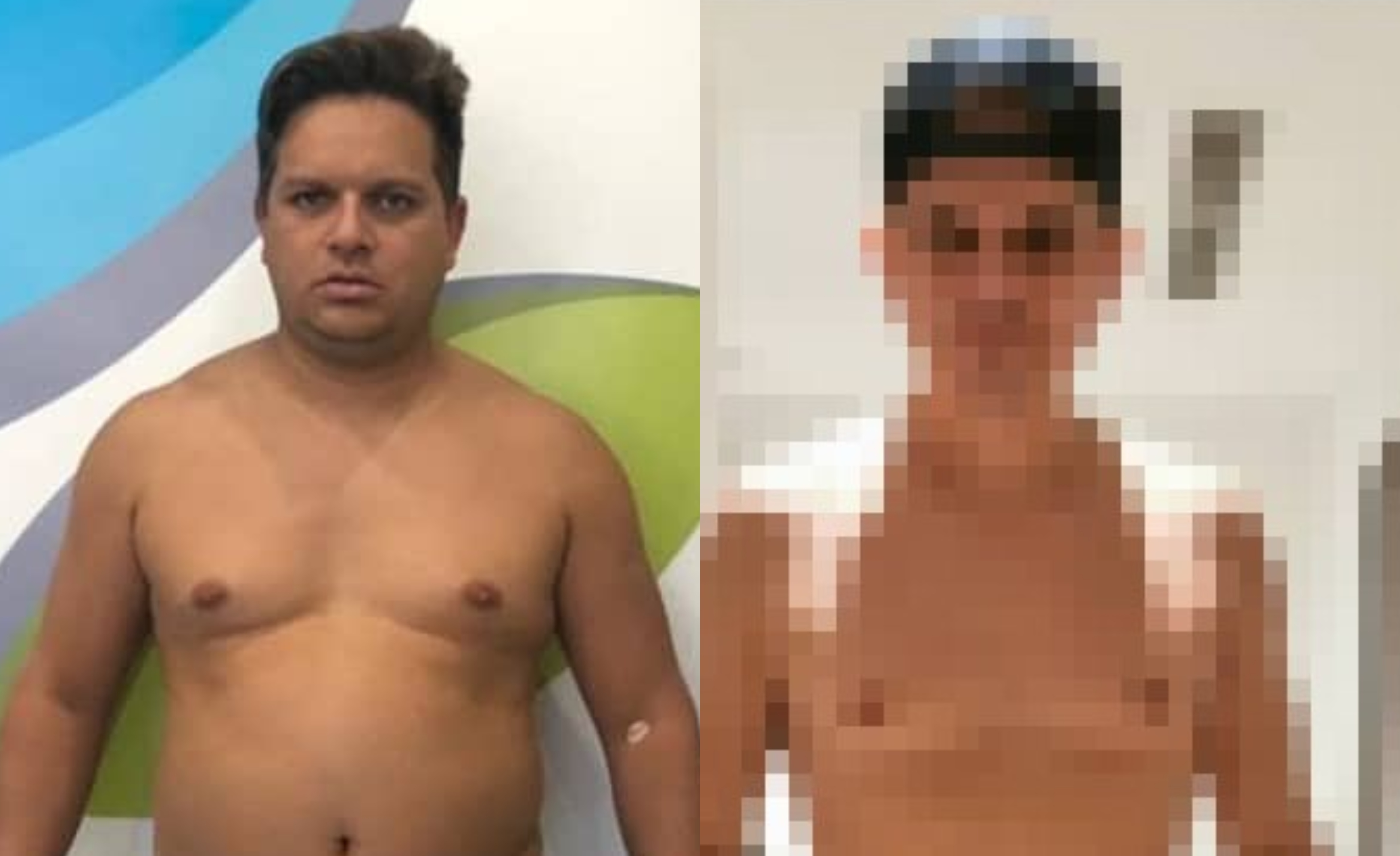 ¡Increíble! Revelan la razón de la repentina pérdida de peso de Omar Acedo (FOTO)