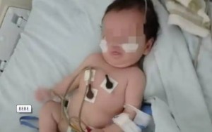 Bebé de venezolanos nació en Colombia con “sangre blanca”, una enfermedad poco común en el mundo