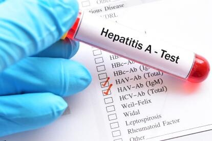 Brasil monitorea 28 casos sospechosos de la hepatitis infantil aguda que se extiende por el mundo