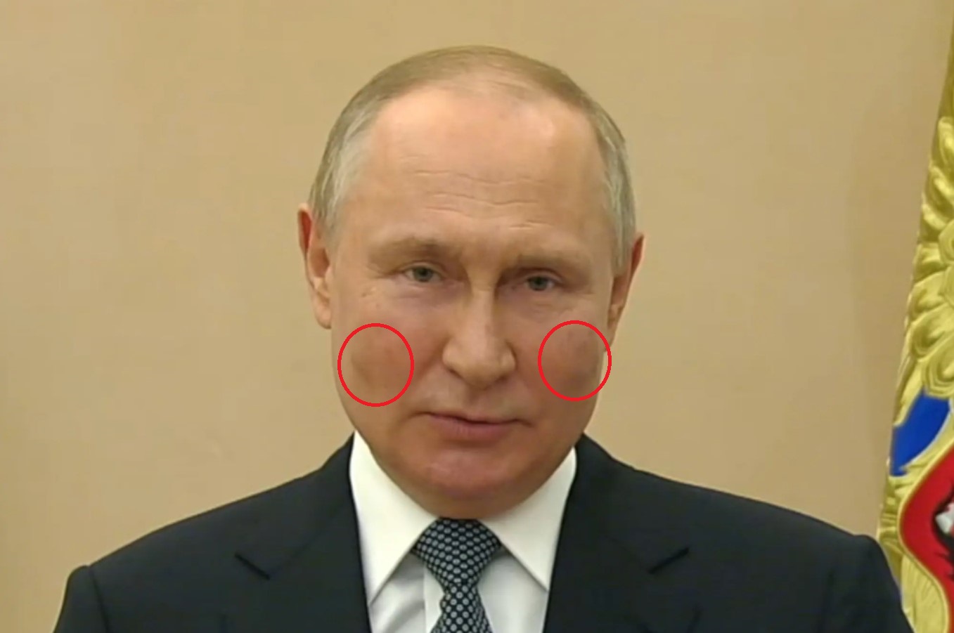 Esta puede ser la mejor evidencia de que Putin no goza de buena salud