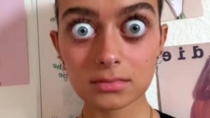 “Me llaman Gollum”: Mujer en Florida arrasa en TikTok por el tamaño de sus ojos (VIDEO)