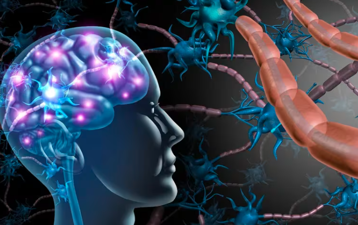 Científicos descubrieron vínculos entre la esclerosis múltiple y el virus de Epstein-Barr